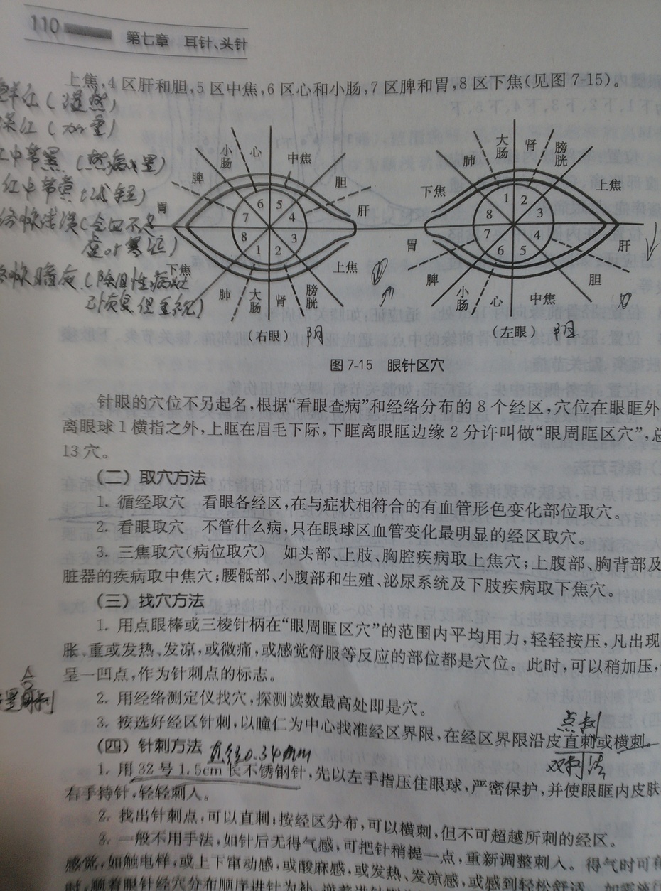 一本教科书关于眼针分区的错误,右眼分区错误-斑蝥的