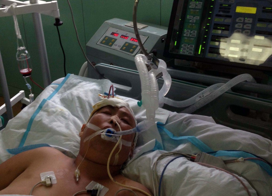 icu—让急危重症患者更安全!