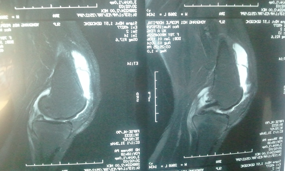 永康市胡军中医诊所细节决定成败--临床治疗启