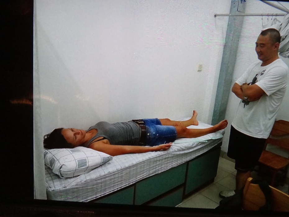 针灸放血治疗颈性眩晕