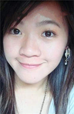 脸上痘痘怎么消除-经典重庆新闻中心-经典重庆