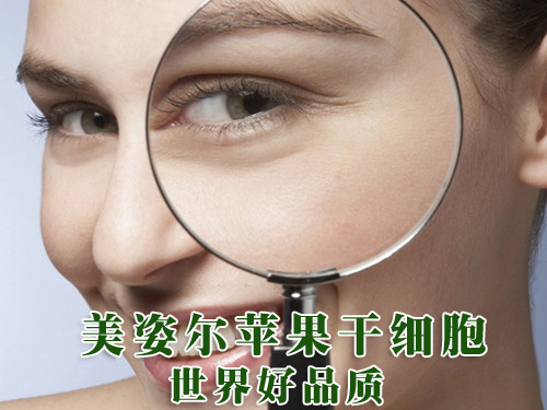 有了眼角纹怎么办 倾城倾国