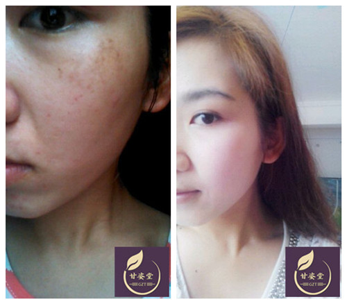 什么化妆品美白祛斑效果好 - 云同盟·生活频道