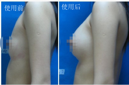 三十岁<em>丰胸</em>方法 让<em>女人</em>无法拒绝的<em>丰胸</em>诱惑-丰