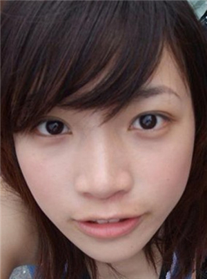 消痘印最好的方法 - 云同盟·生活频道