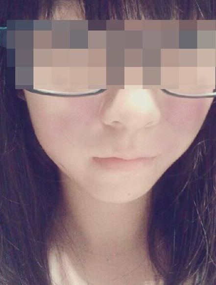 面部皮肤过敏怎么办洗头难于蹬青天,莫因青忙