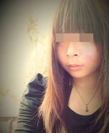 脸上过敏痒怎么办,瞧我咸鱼也能翻身化身浓桃