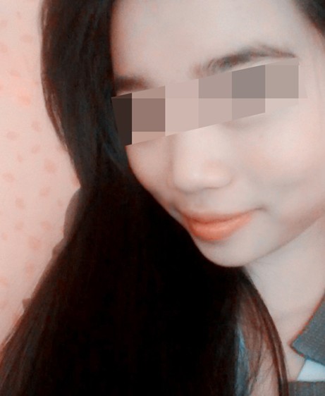 皮肤过敏吃什么药,犄角旮旯藏丑脸,重觅靓颜乐