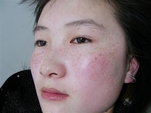 教你如何分辨各种斑 - 英雄三国 - MOBA游戏中