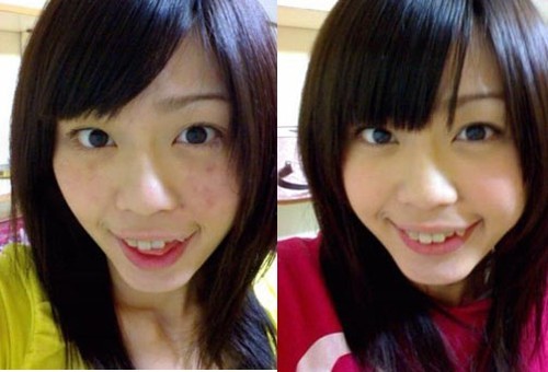 适合中学生去痘痘的最好方法