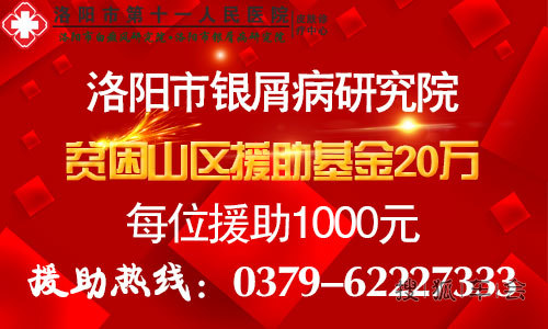 洛阳白癜风专家讲述在洛阳哪里能治愈白癜风 