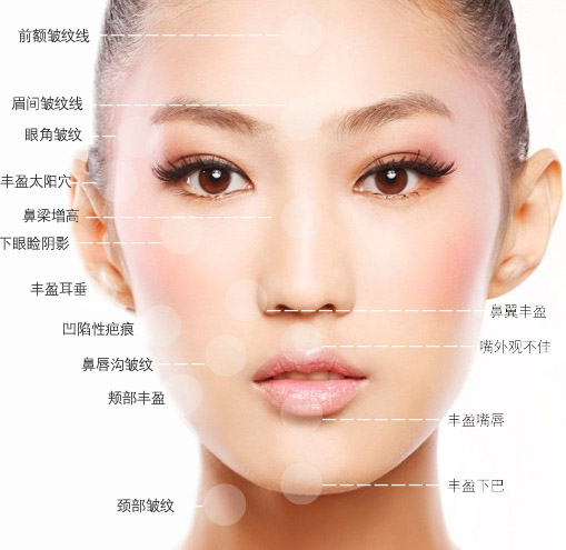 微整形二"午休美容"的问题你知道吗?