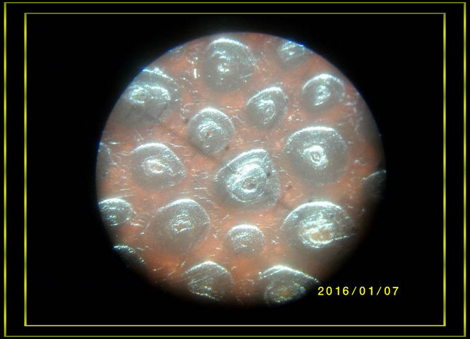 犀牛角方块,鱼籽鲕状纹结构,倍率40.